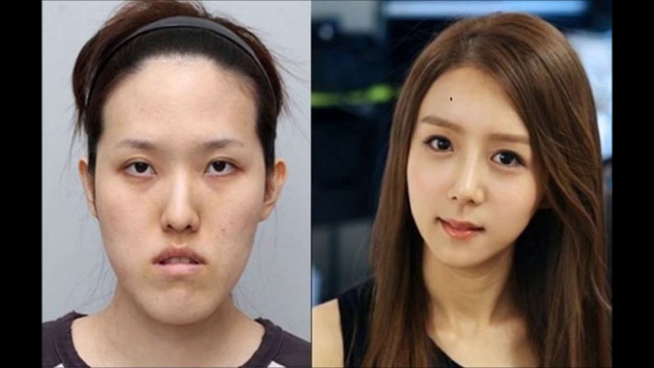 【閲覧注意】韓国整形、美人双子姉妹の劇的ビフォーアフターが衝撃的すぎ、本当に整形は怖い！ Plastic Surgery Before And After＜unknow World